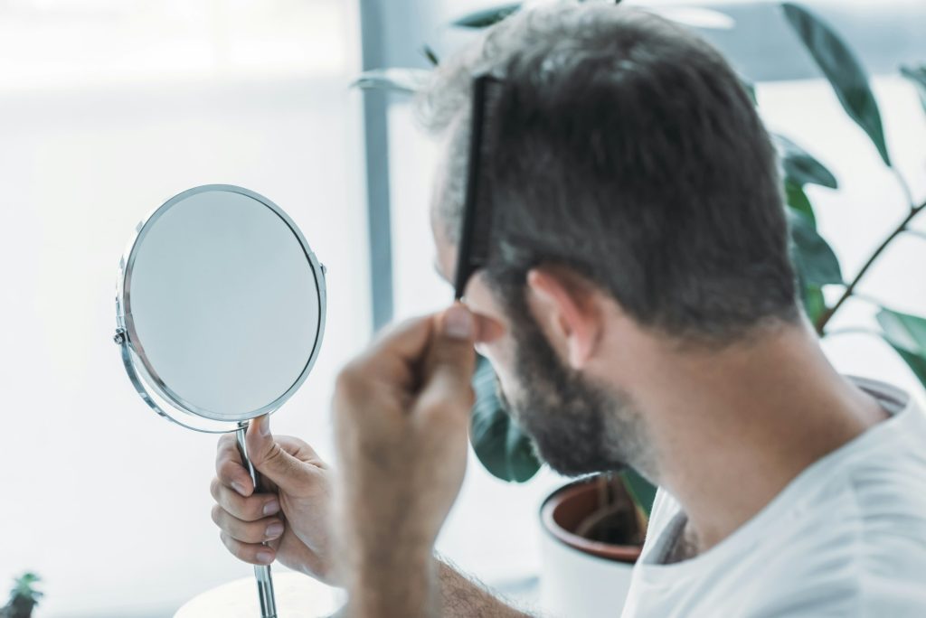 middle aged man combing hair and looking at mirror, hair loss concept- mitos sobre el injerto capilar desmentidos - uve medical, clinica de estetica capilar y facial