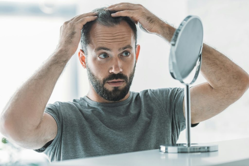 hair loss-¿Es Posible Realizar un Injerto Capilar sin Rapar el Cabello?-UVEMedical, ser una clinica pionera en injertis capilares y otros tratamientos esteticos
